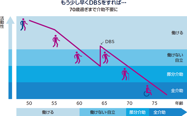もう少し早くDBSをすれば