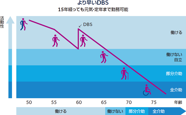 より早い DBS