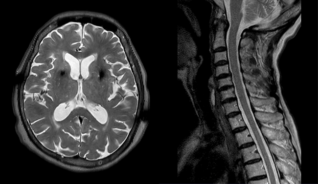 MRI 撮影イメージ